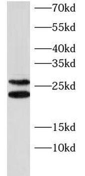 TMEM41B Rabbit Polyclonal Antibody