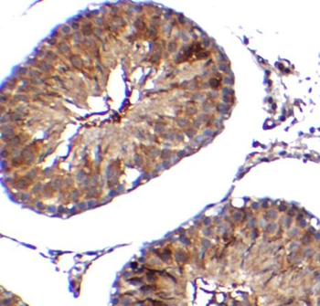 TMEM41B Antibody