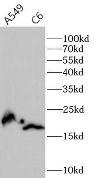 NME1 Rabbit Polyclonal Antibody