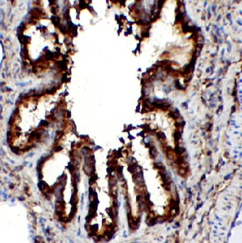 NME1 Rabbit Polyclonal Antibody