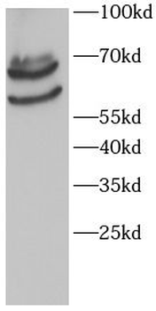 SPINT1 Antibody