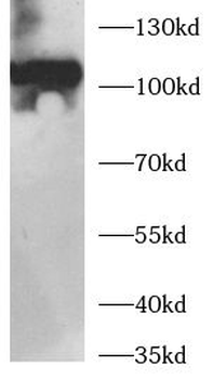 ROBO4 Antibody