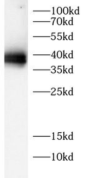 PPP1R15A Antibody