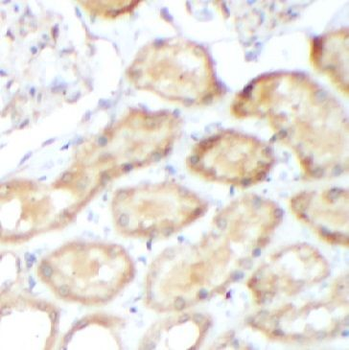 PPP1R15A Rabbit Polyclonal Antibody