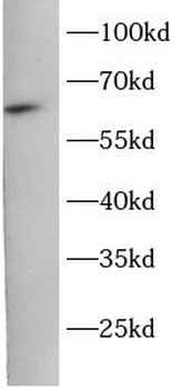 IGF2BP3 Antibody