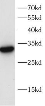 MED19 Antibody