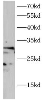 ING2 Antibody
