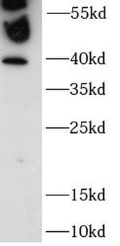 ZNF140 Rabbit Polyclonal Antibody