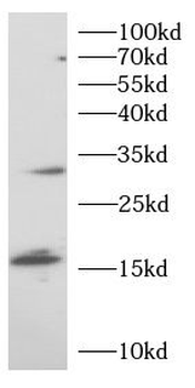 TREM1 Antibody