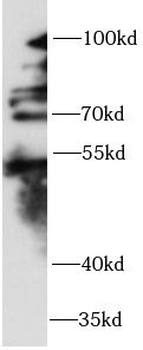 ZNF746 Antibody