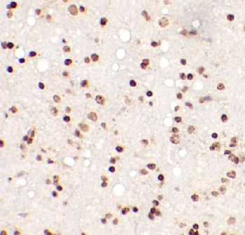 CDK2AP1 Antibody
