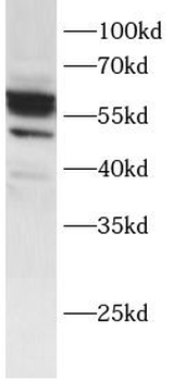 TP63 Rabbit Polyclonal Antibody