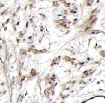 TP63 Rabbit Polyclonal Antibody
