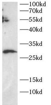 SECTM1 Antibody