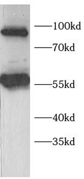 DAB2 Rabbit Polyclonal Antibody