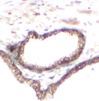 DAB2 Rabbit Polyclonal Antibody