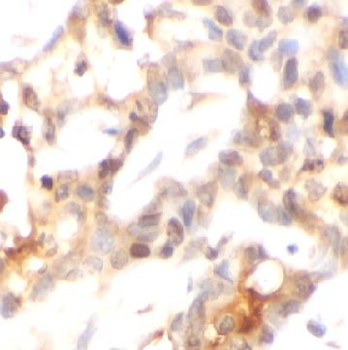 MRPL58 Rabbit Polyclonal Antibody