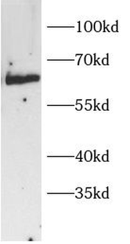 IRF2BP2 Antibody