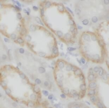 ITK Rabbit Polyclonal Antibody