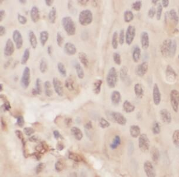 KRT1 Antibody