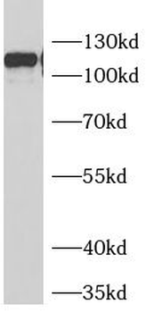 GRIN1 Rabbit Polyclonal Antibody