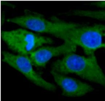 NES Rabbit Polyclonal Antibody