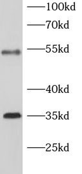 SLC7A11 Antibody