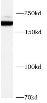 SCN7A Antibody