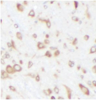 CPT1C Antibody