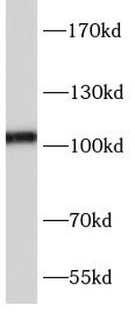 GRIA1 Rabbit Polyclonal Antibody