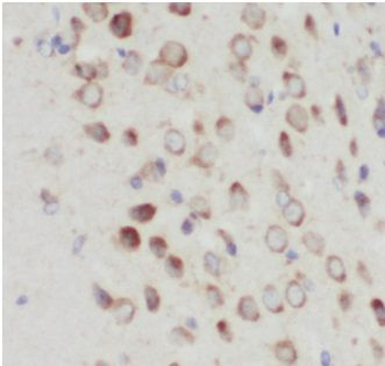 GRIA1 Rabbit Polyclonal Antibody