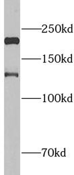 PPL Antibody