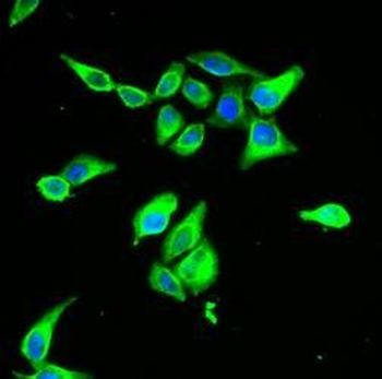 CD55 Rabbit Polyclonal Antibody