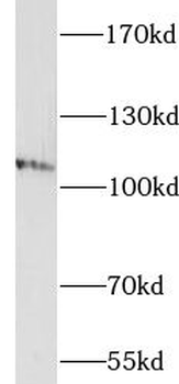 IQSEC1 Antibody