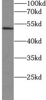 Phospho-GSK3B (Ser9) Antibody
