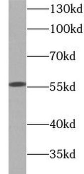 GPI Mouse Monoclonal Antibody