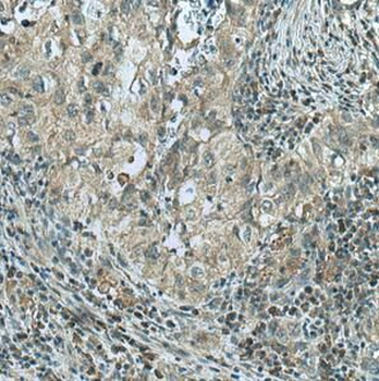 GPI Mouse Monoclonal Antibody