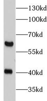 MMP16 Antibody