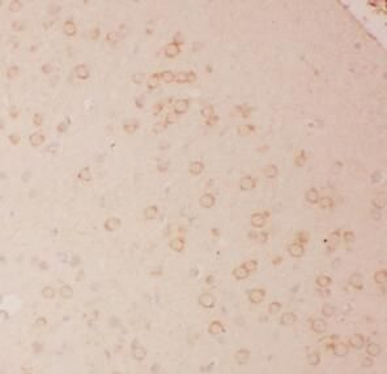 IL13 Rabbit Polyclonal Antibody
