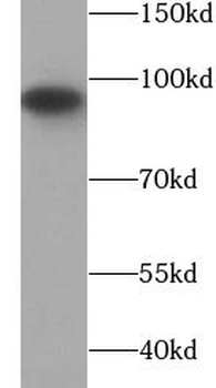 SP1 Rabbit Polyclonal Antibody