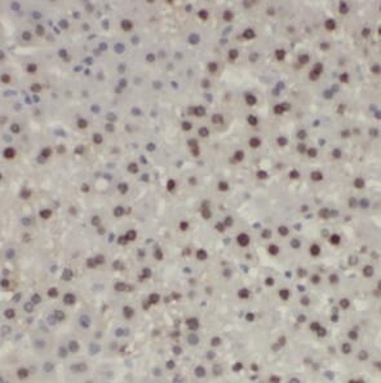 SP1 Rabbit Polyclonal Antibody