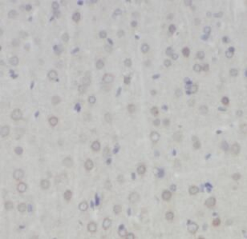 HTR1A Rabbit Polyclonal Antibody