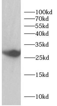 GSTO1 Antibody