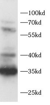 ADAM28 Antibody