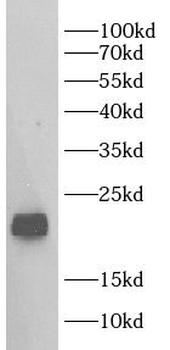 GPX4 Rabbit Polyclonal Antibody