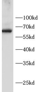 EIF2AK1 Rabbit Polyclonal Antibody