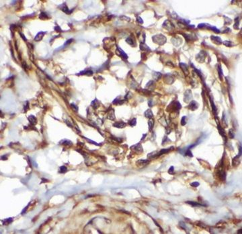 EIF2AK1 Rabbit Polyclonal Antibody