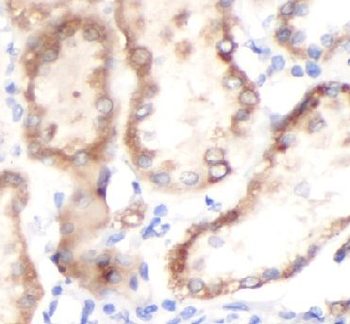 CRAT Rabbit Polyclonal Antibody
