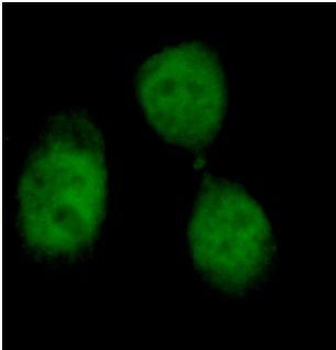 γ H2AX Rabbit Polyclonal Antibody