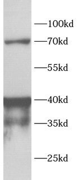 ADA Antibody